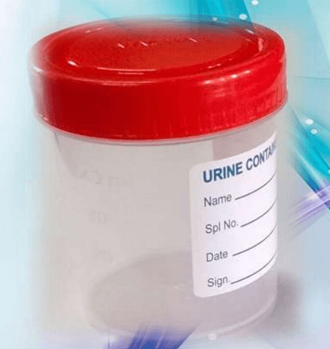 Urine Container